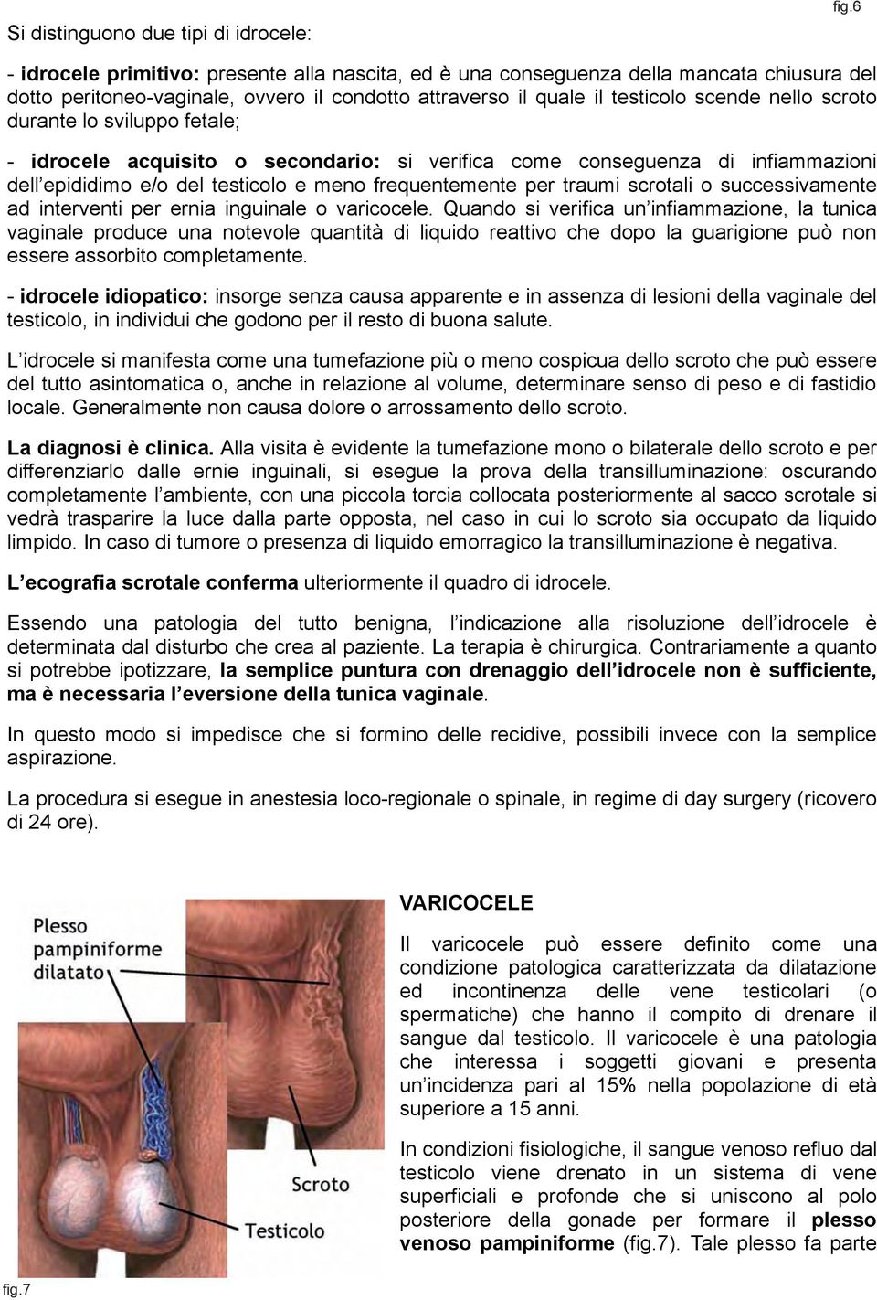 durante lo sviluppo fetale; - idrocele acquisito o secondario: si verifica come conseguenza di infiammazioni dell epididimo e/o del testicolo e meno frequentemente per traumi scrotali o