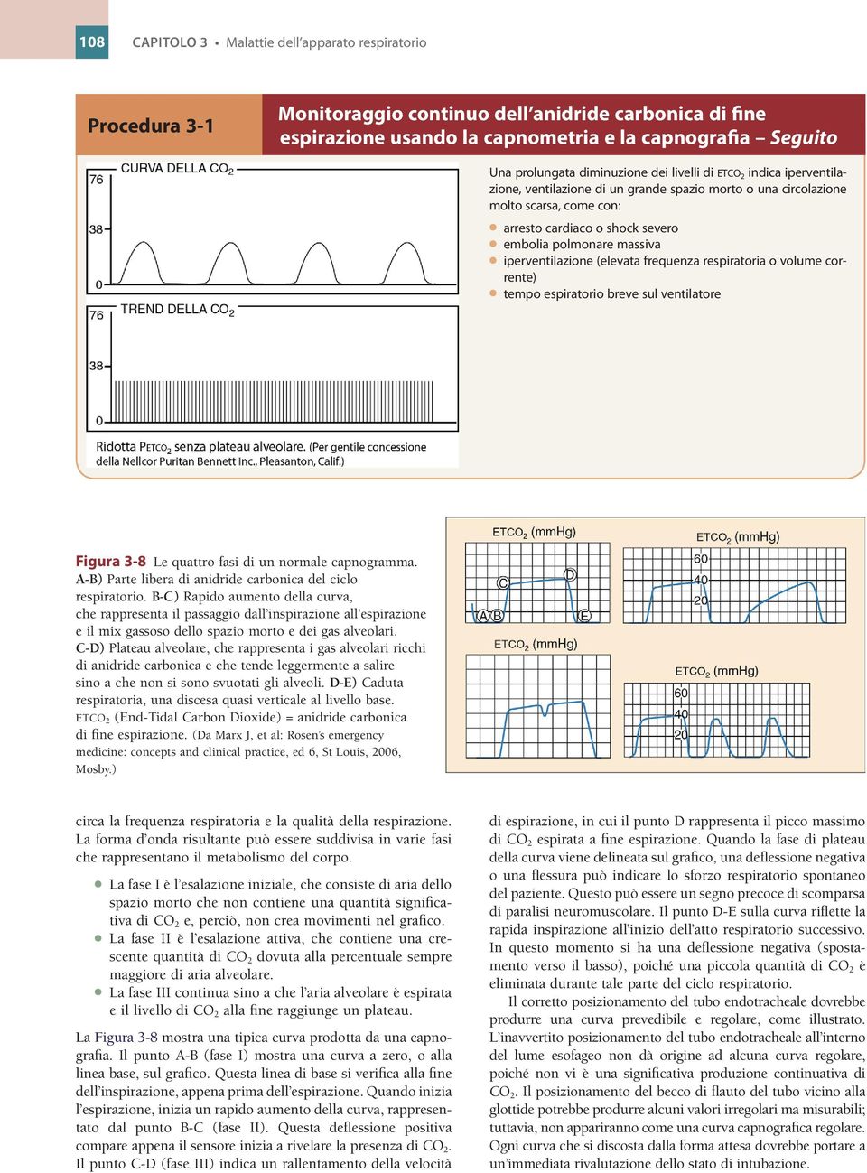 iperventilazione (elevata frequenza respiratoria o volume corrente) tempo espiratorio breve sul ventilatore Figura 3-8 Le quattro fasi di un normale capnogramma.