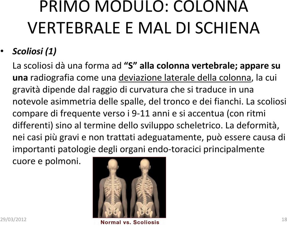 fianchi. La scoliosi compare di frequente verso i 9-11 anni e si accentua (con ritmi differenti) sino al termine dello sviluppo scheletrico.