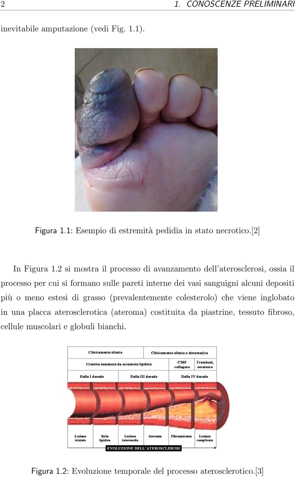 2 si mostra il processo di avanzamento dell aterosclerosi, ossia il processo per cui si formano sulle pareti interne dei vasi sanguigni