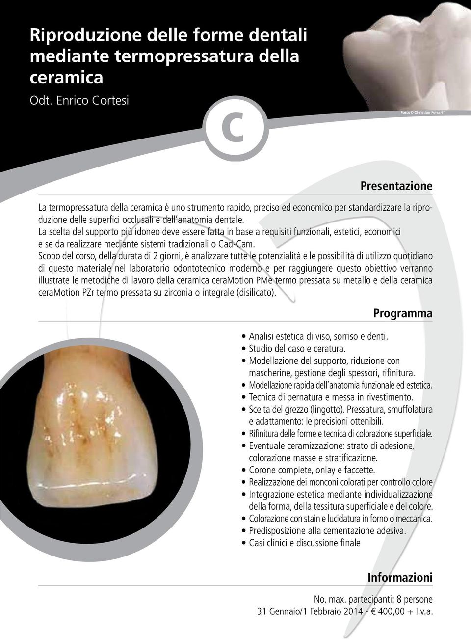 dell anatomia dentale. La scelta del supporto più idoneo deve essere fatta in base a requisiti funzionali, estetici, economici e se da realizzare mediante sistemi tradizionali o Cad-Cam.