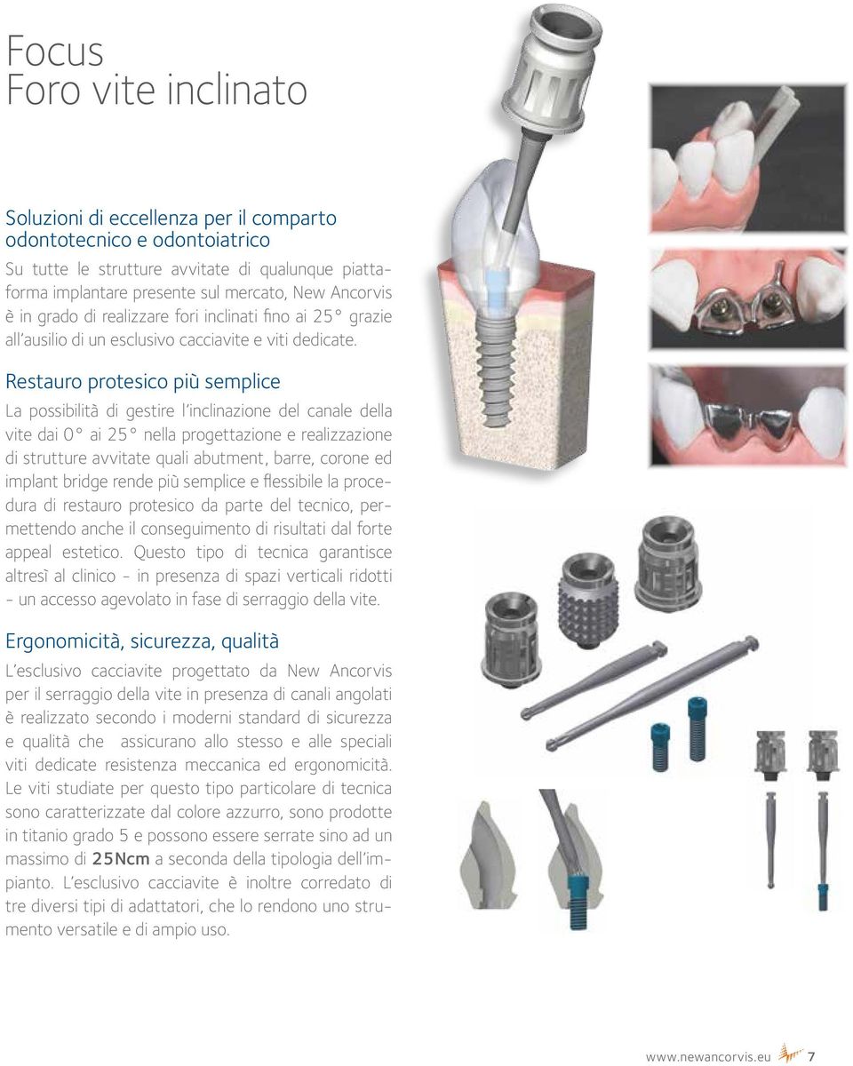 Restauro protesico più semplice La possibilità di gestire l inclinazione del canale della vite dai 0 ai 25 nella progettazione e realizzazione di strutture avvitate quali abutment, barre, corone ed