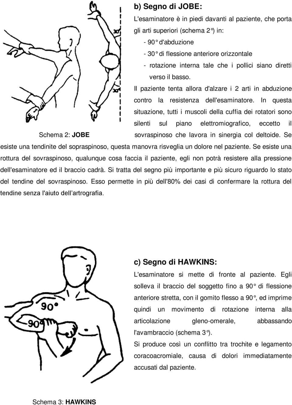 In questa situazione, tutti i muscoli della cuffia dei rotatori sono silenti sul piano elettromiografico, eccetto il Schema 2: JOBE sovraspinoso che lavora in sinergia col deltoide.