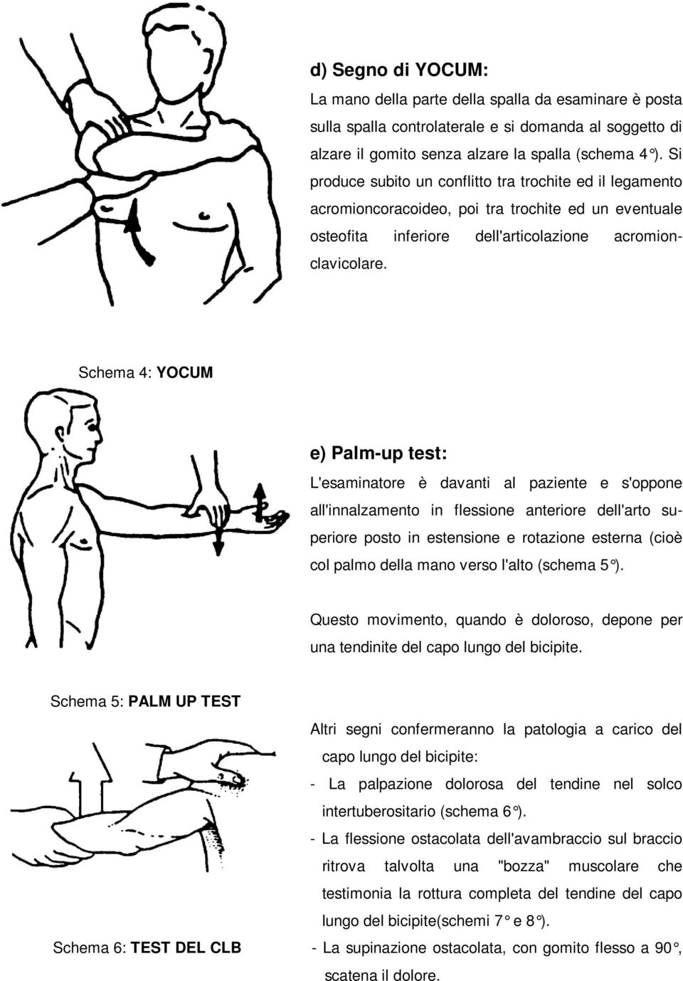 Schema 4: YOCUM e) Palm-up test: L'esaminatore è davanti al paziente e s'oppone all'innalzamento in flessione anteriore dell'arto superiore posto in estensione e rotazione esterna (cioè col palmo
