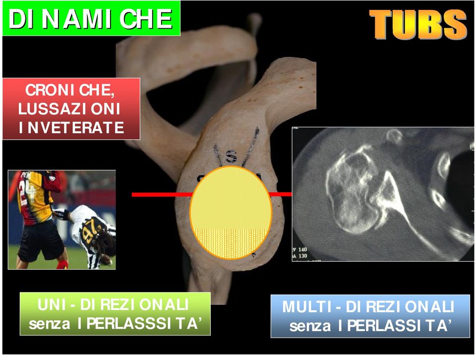 UNI-DIREZIONALI senza