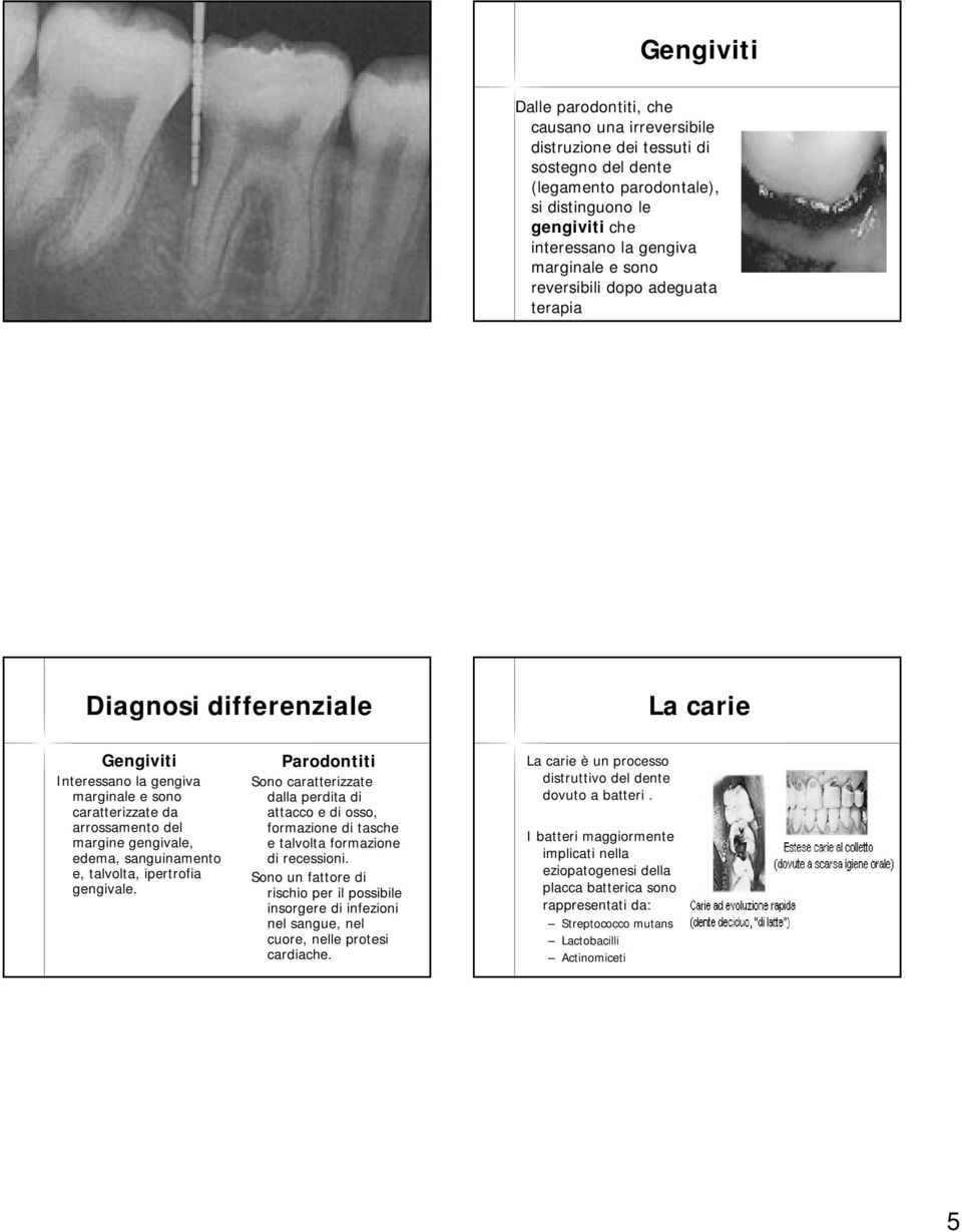 talvolta, ipertrofia gengivale. Parodontiti Sono caratterizzate dalla perdita di attacco e di osso, formazione di tasche e talvolta formazione di recessioni.