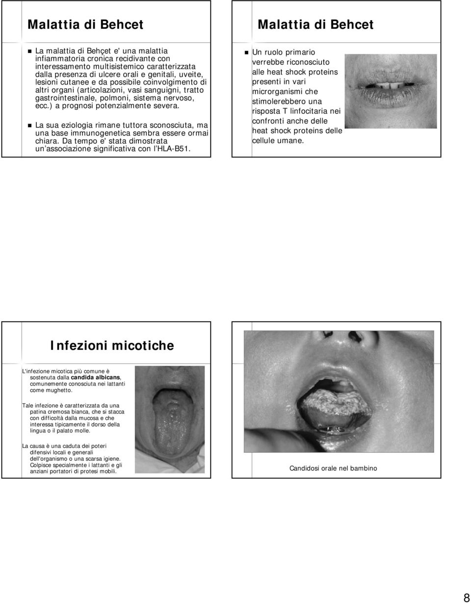 La sua eziologia rimane tuttora sconosciuta, ma una base immunogenetica sembra essere ormai chiara. Da tempo e' stata dimostrata un associazione significativa con l HLA-B51.