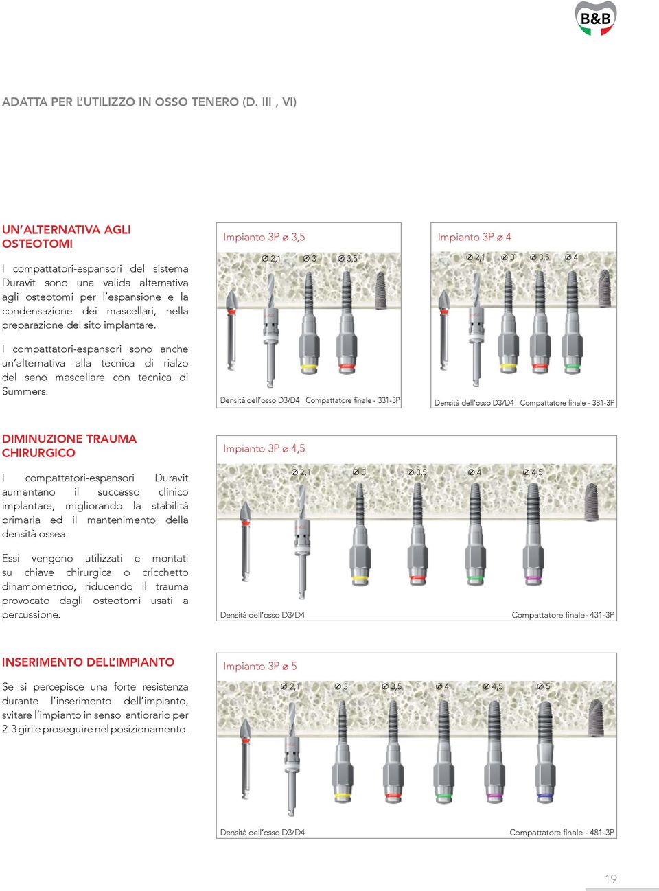 del sito implantare. I compattatori-espansori sono anche un alternativa alla tecnica di rialzo del seno mascellare con tecnica di Summers.