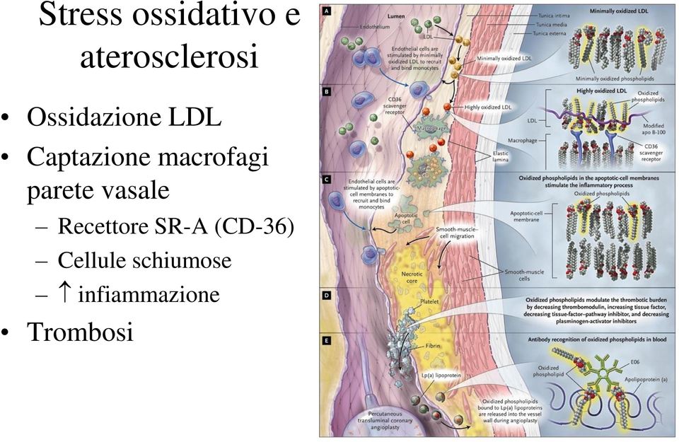 (CD-36) Cellule schiumose infiammazione Trombosi