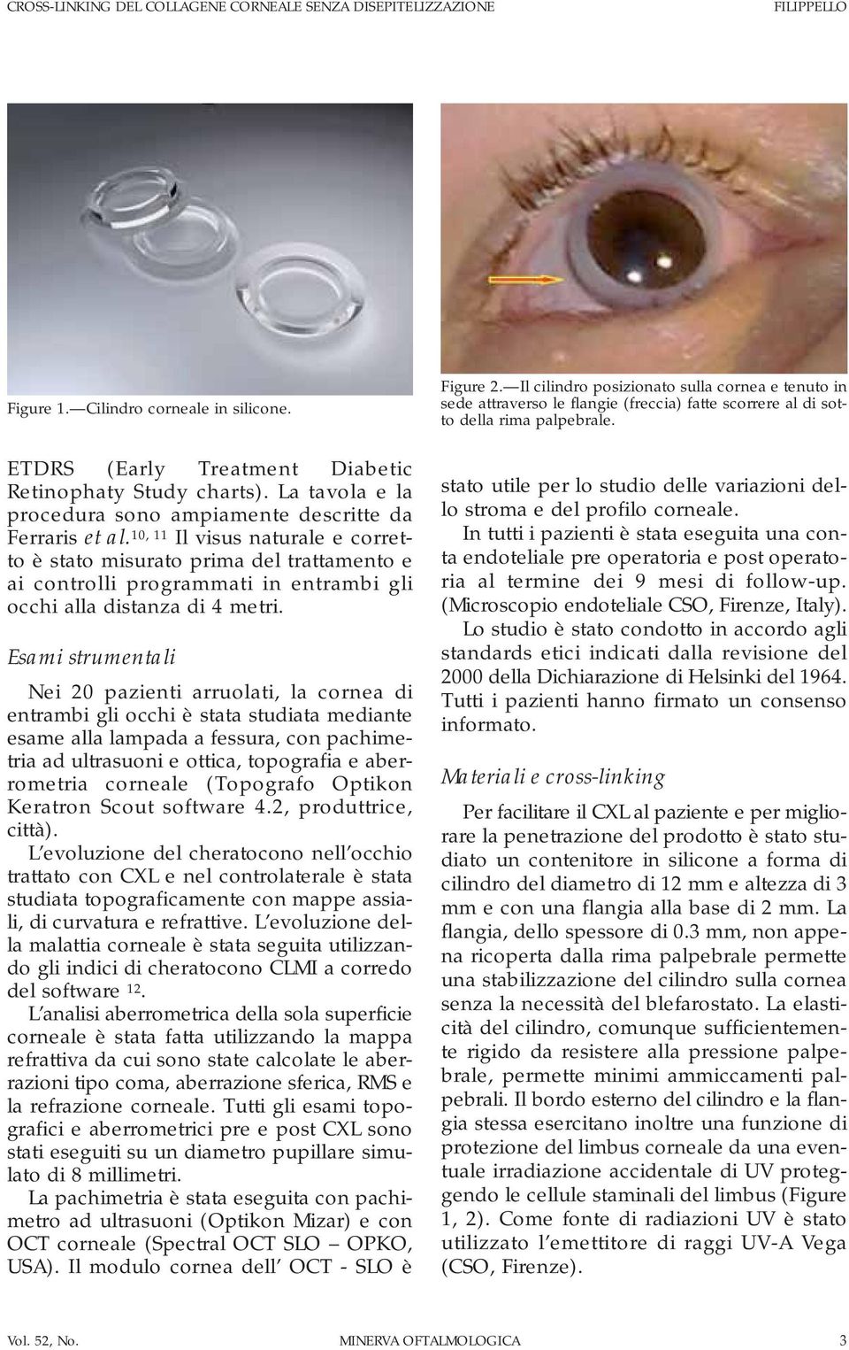 10, 11 Il visus naturale e corretto è stato misurato prima del trattamento e ai controlli programmati in entrambi gli occhi alla distanza di 4 metri.