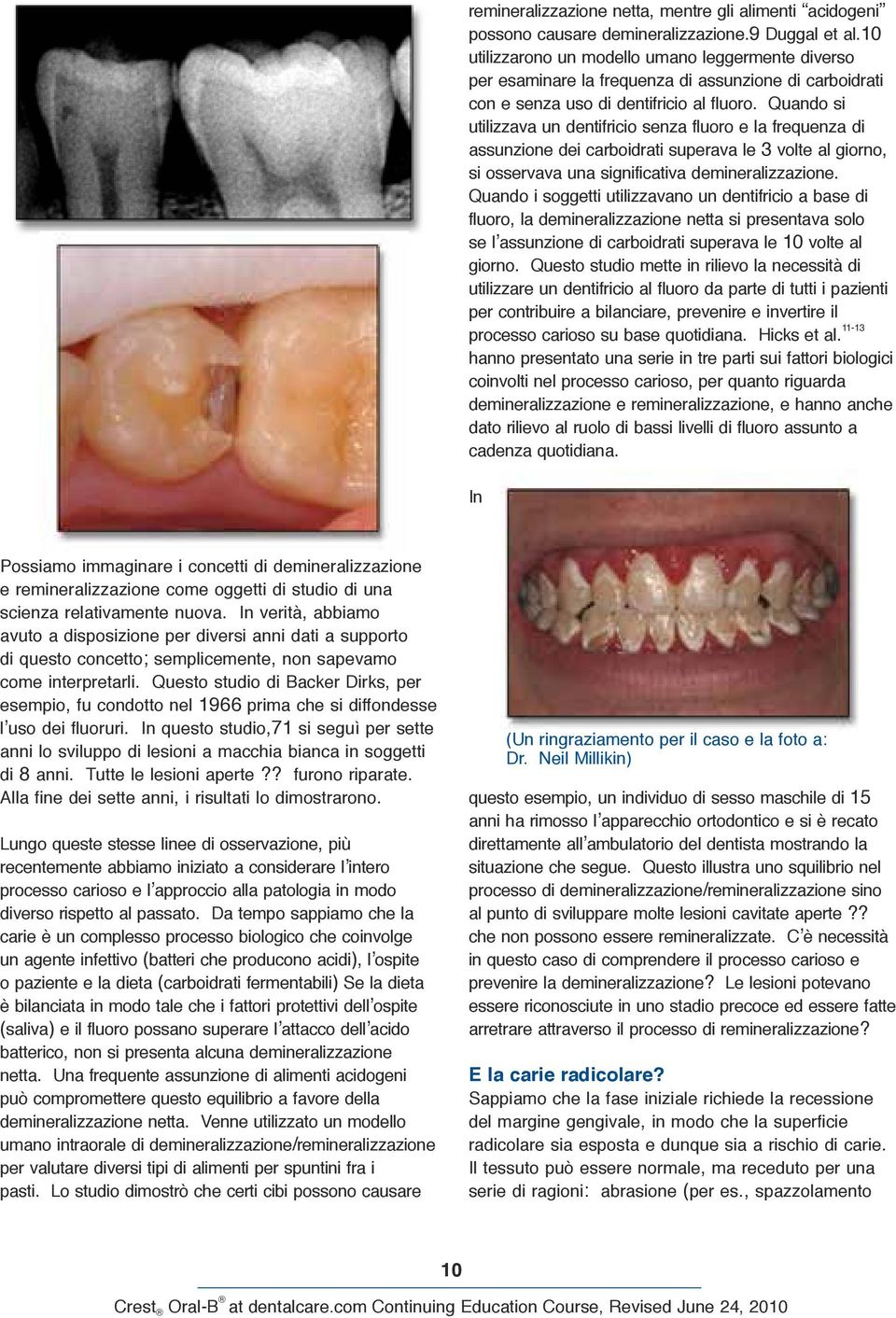 Quando si utilizzava un dentifricio senza fluoro e la frequenza di assunzione dei carboidrati superava le 3 volte al giorno, si osservava una significativa demineralizzazione.