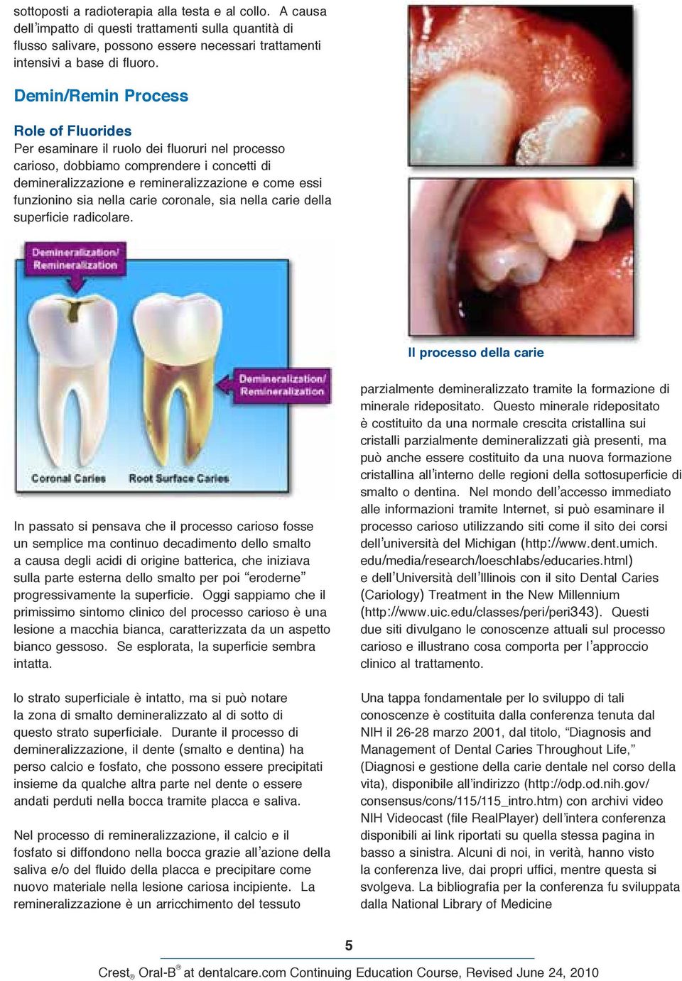 nella carie coronale, sia nella carie della superficie radicolare.