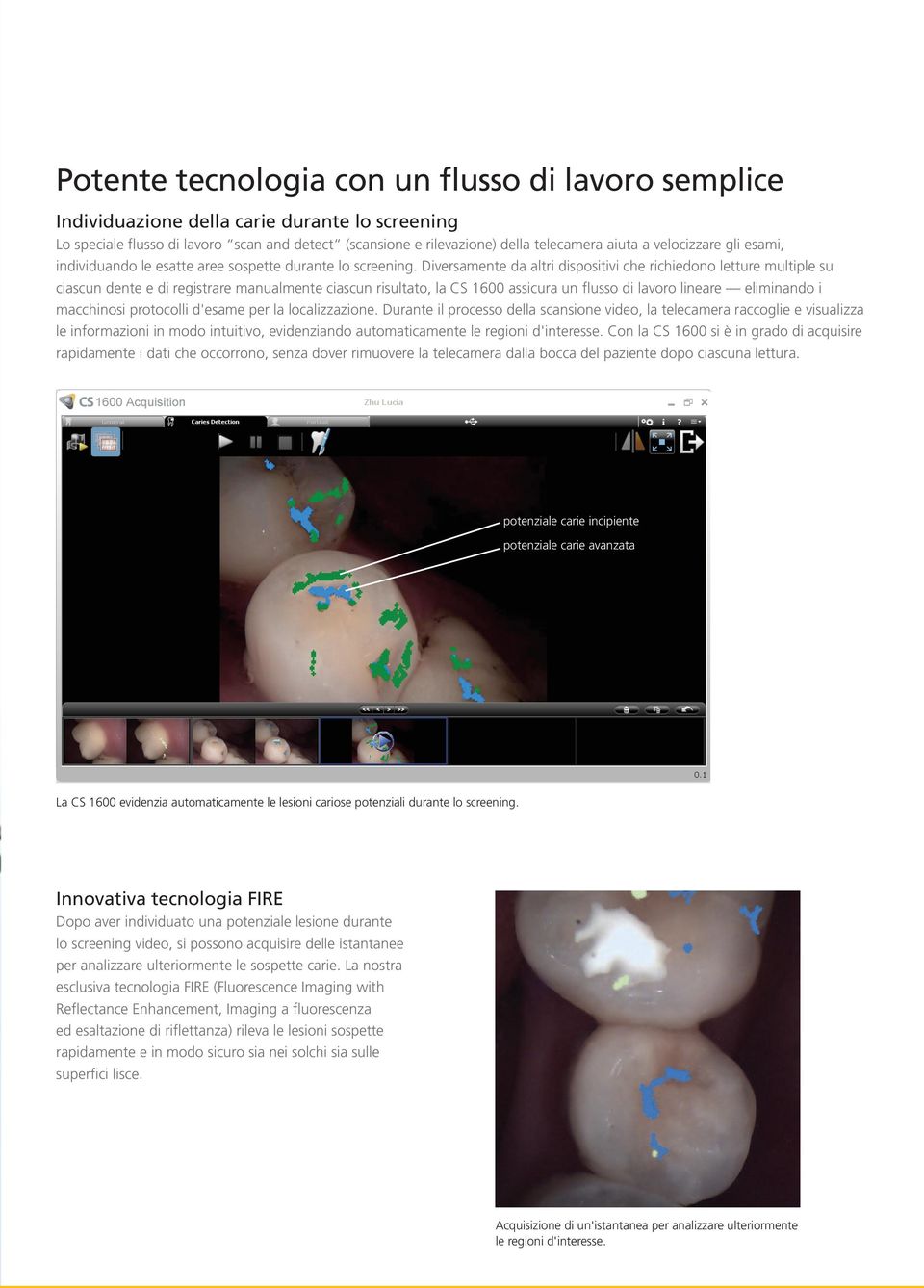 Diversamente da altri dispositivi che richiedono letture multiple su ciascun dente e di registrare manualmente ciascun risultato, la CS 1600 assicura un flusso di lavoro lineare eliminando i