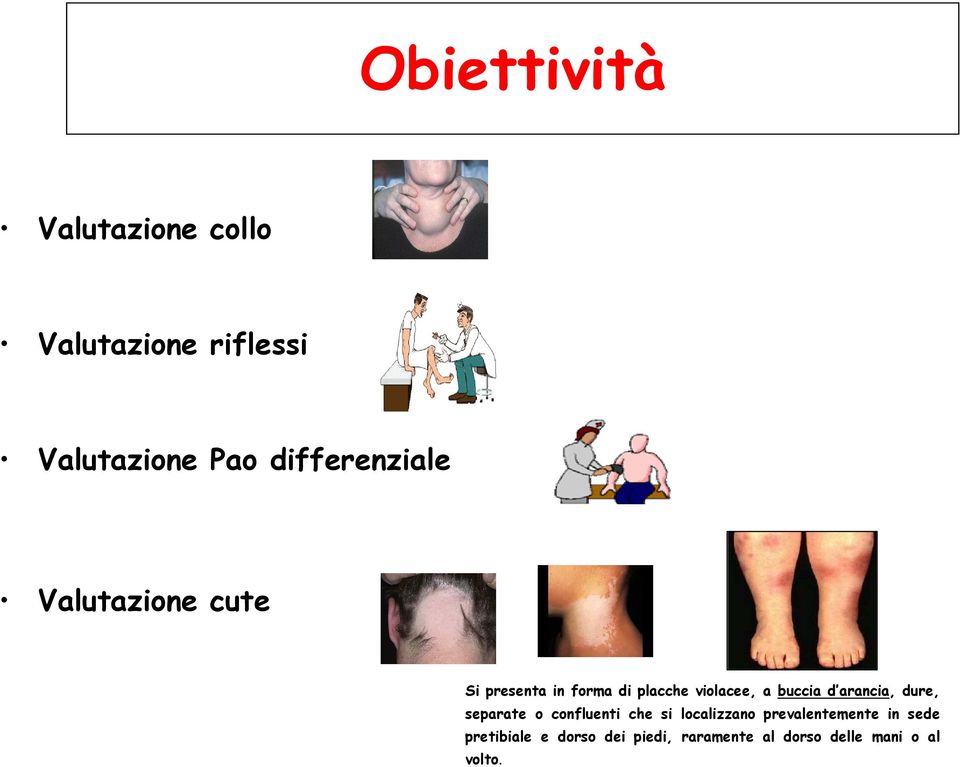 buccia d arancia, dure, separate o confluenti che si localizzano