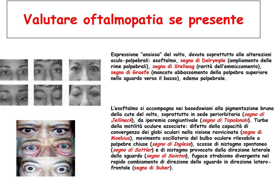 L esoftalmo si accompagna nei basedowiani alla pigmentazione bruna della cute del volto, soprattutto in sede periorbitaria (segno di Jellineck), da iperemia congiuntivale (segno di Topolanski).