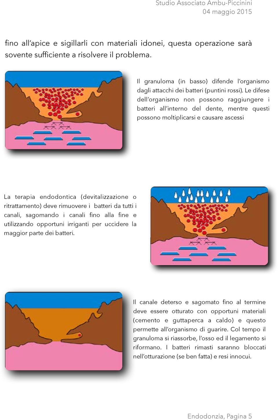 Le difese dell organismo non possono raggiungere i batteri all interno del dente, mentre questi possono moltiplicarsi e causare ascessi La terapia endodontica (devitalizzazione o ritrattamento) deve