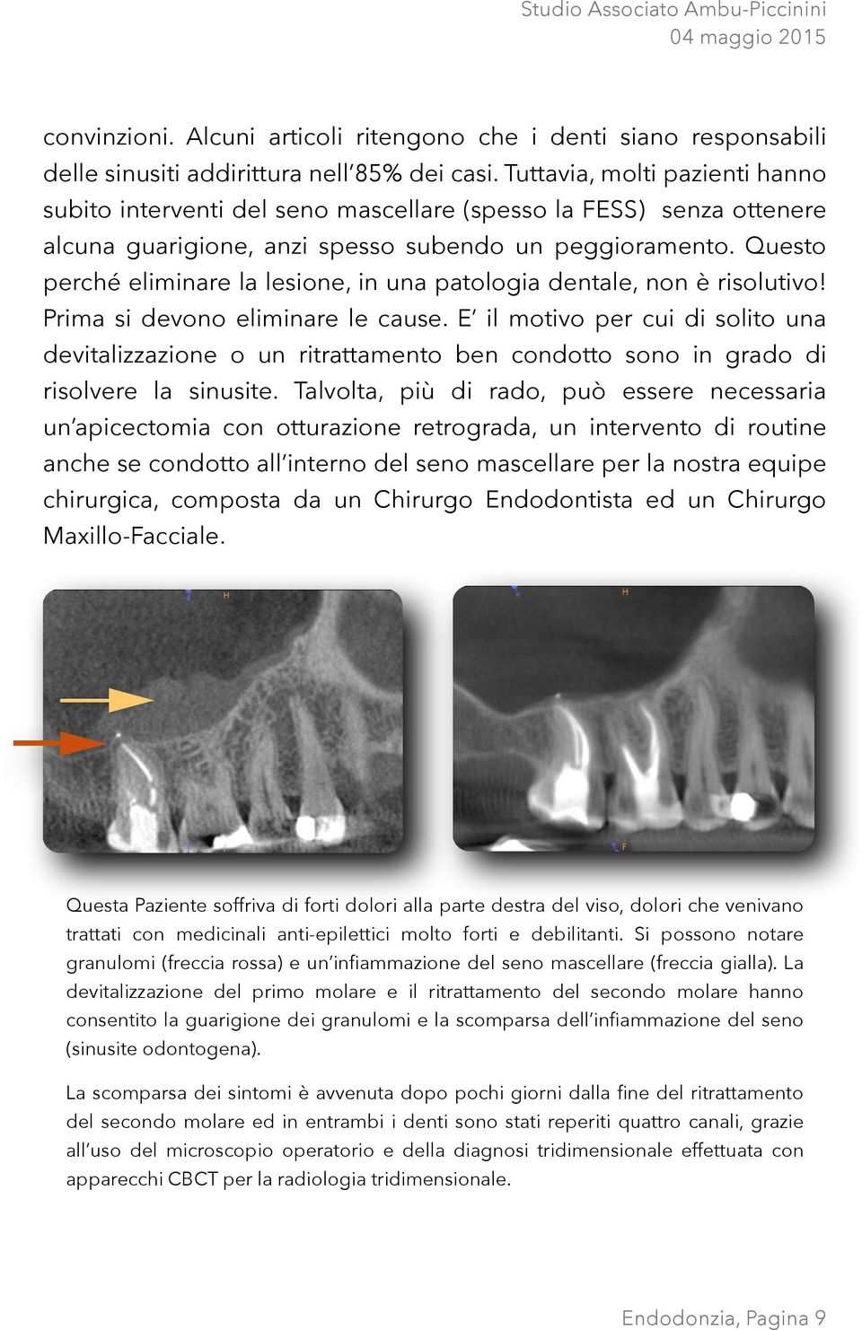 Questo perché eliminare la lesione, in una patologia dentale, non è risolutivo! Prima si devono eliminare le cause.