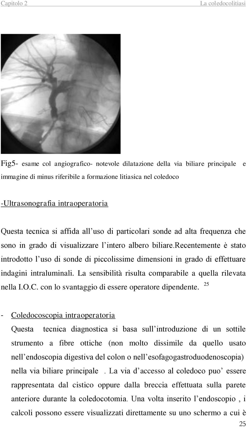 recentemente è stato introdotto l uso di sonde di piccolissime dimensioni in grado di effettuare indagini intraluminali. La sensibilità risulta comparabile a quella rilevata nella I.O.C.