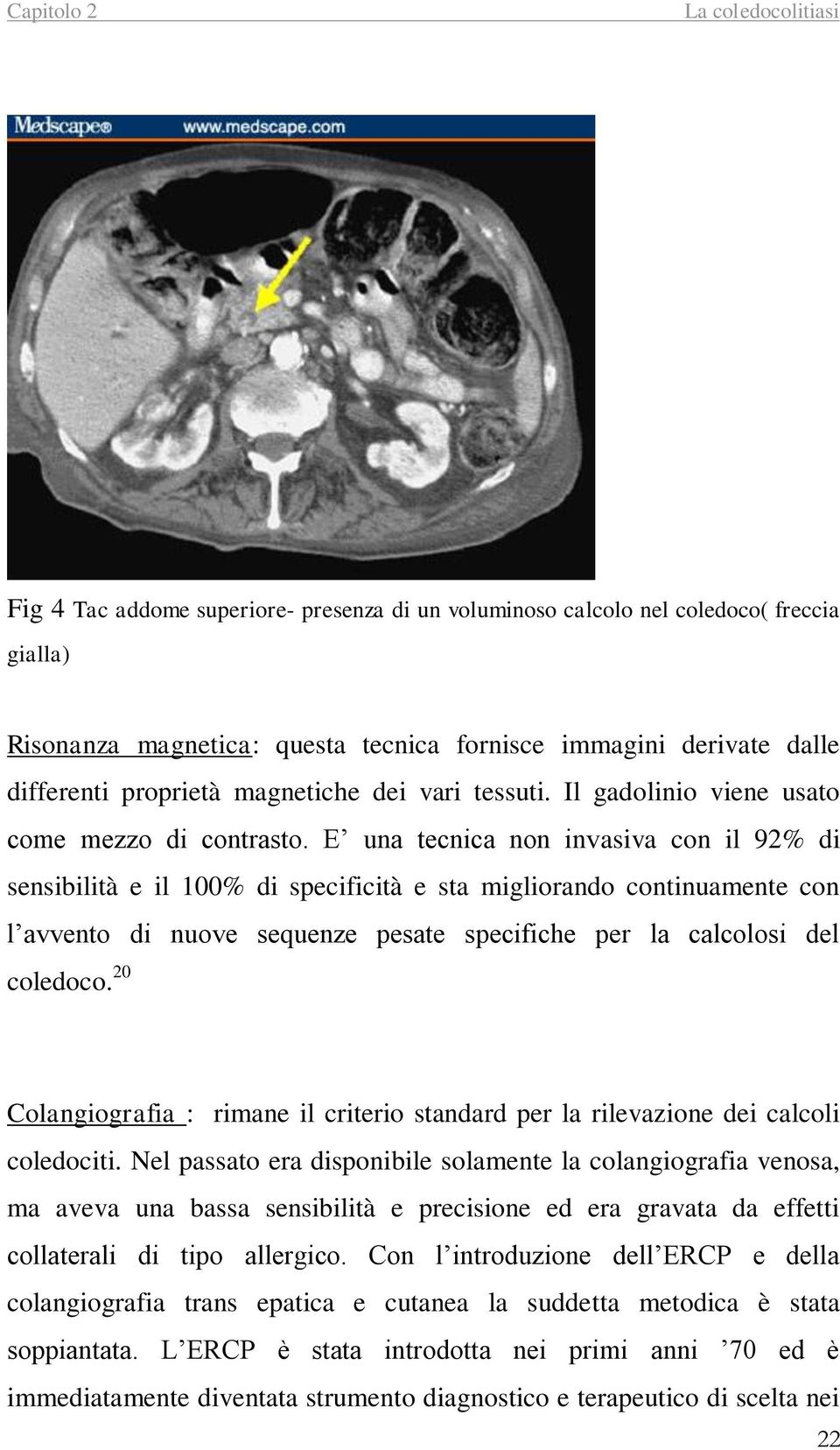 E una tecnica non invasiva con il 92% di sensibilità e il 100% di specificità e sta migliorando continuamente con l avvento di nuove sequenze pesate specifiche per la calcolosi del coledoco.