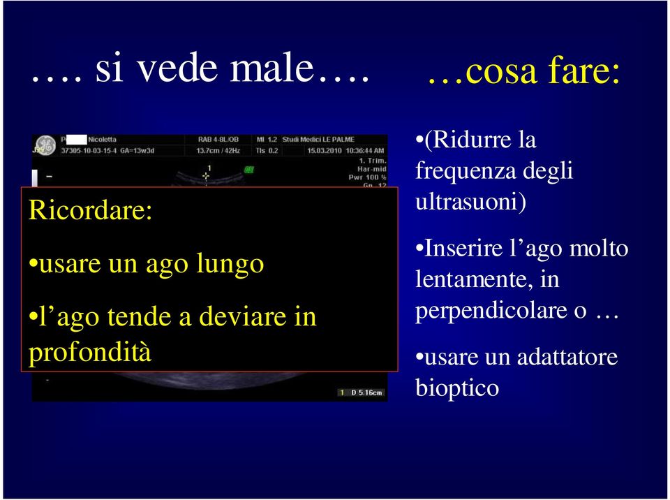 a deviare in profondità (Ridurre la frequenza degli