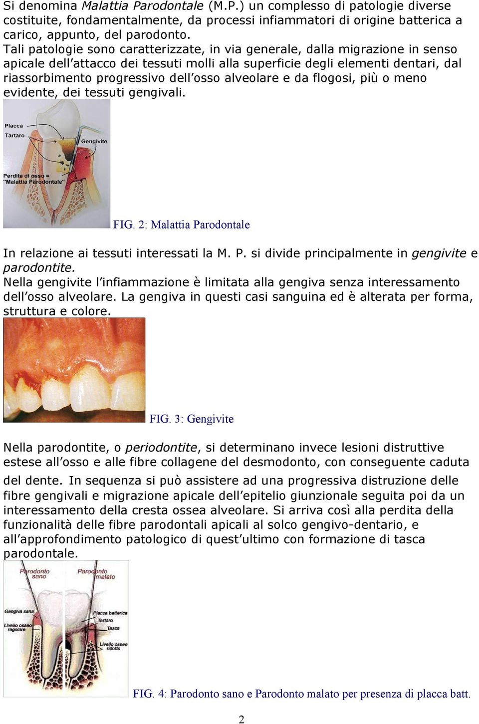 alveolare e da flogosi, più o meno evidente, dei tessuti gengivali. FIG. 2: Malattia Parodontale In relazione ai tessuti interessati la M. P. si divide principalmente in gengivite e parodontite.