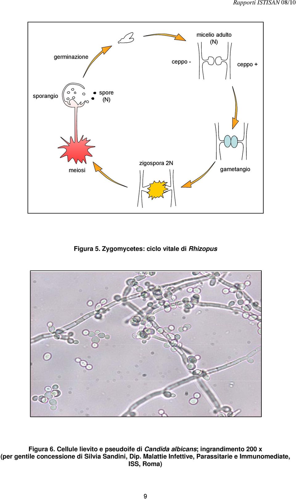 Cellule lievito e pseudoife di Candida albicans; ingrandimento 200 x (per gentile