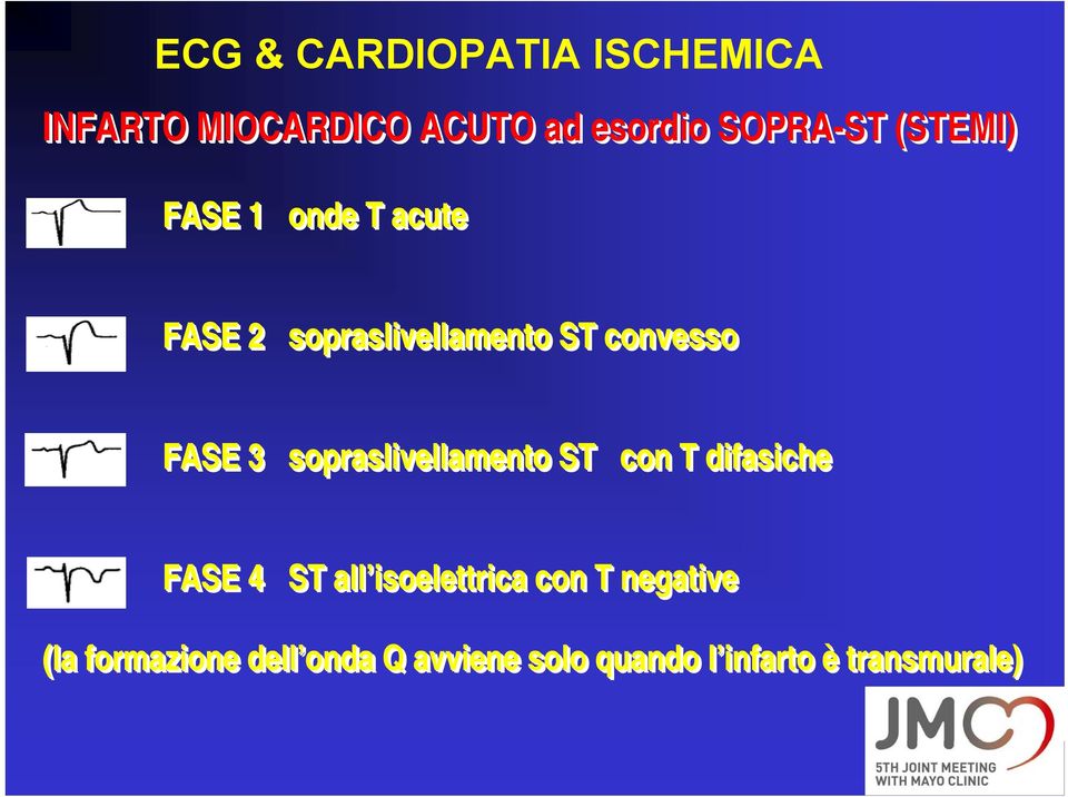 sopraslivellamento ST con T difasiche FASE 4 ST all isoelettrica con T