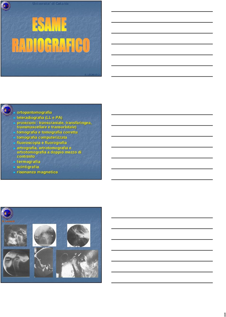 tomografia computerizzata fluoroscopia e fluorografia artrografia,