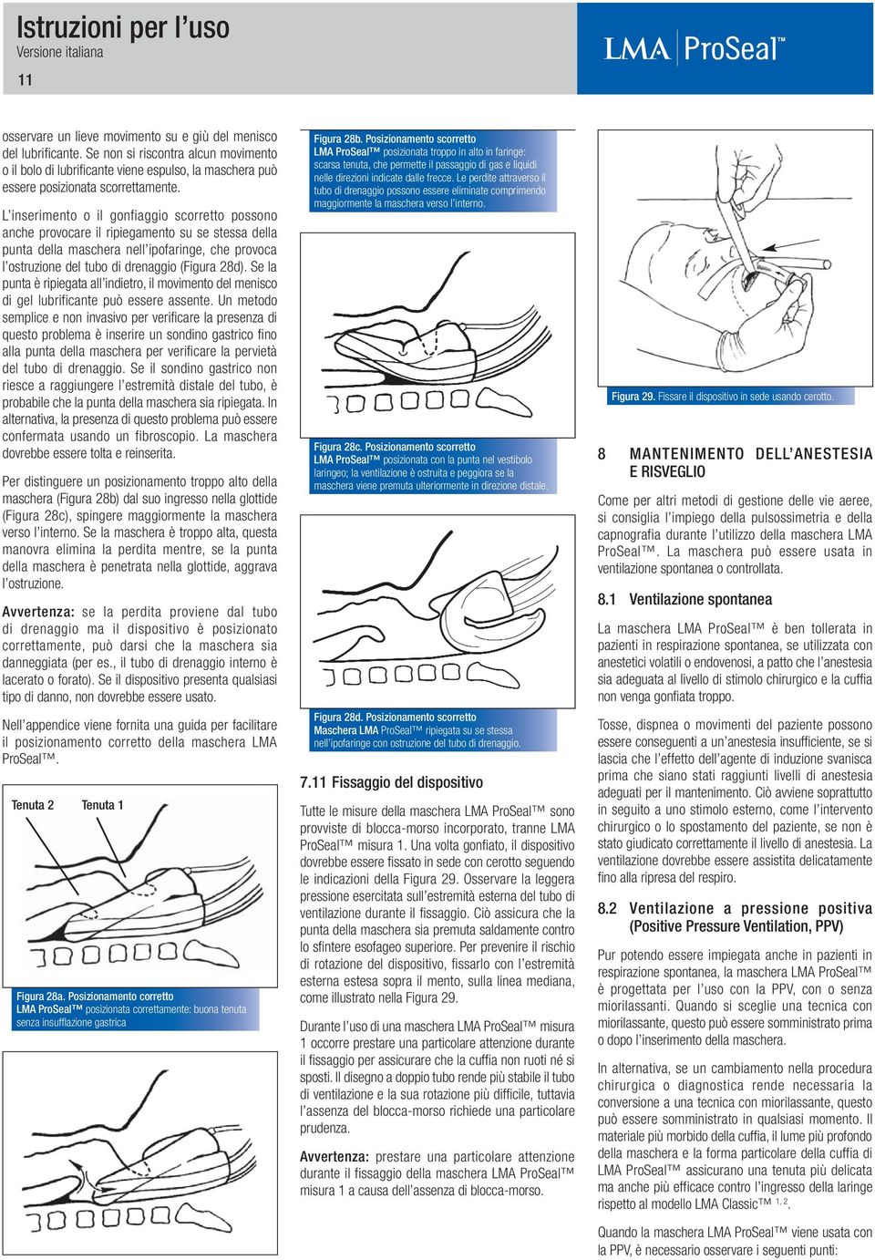 Se la punta è ripiegata all indietro, il movimento del menisco di gel lubrificante può essere assente.