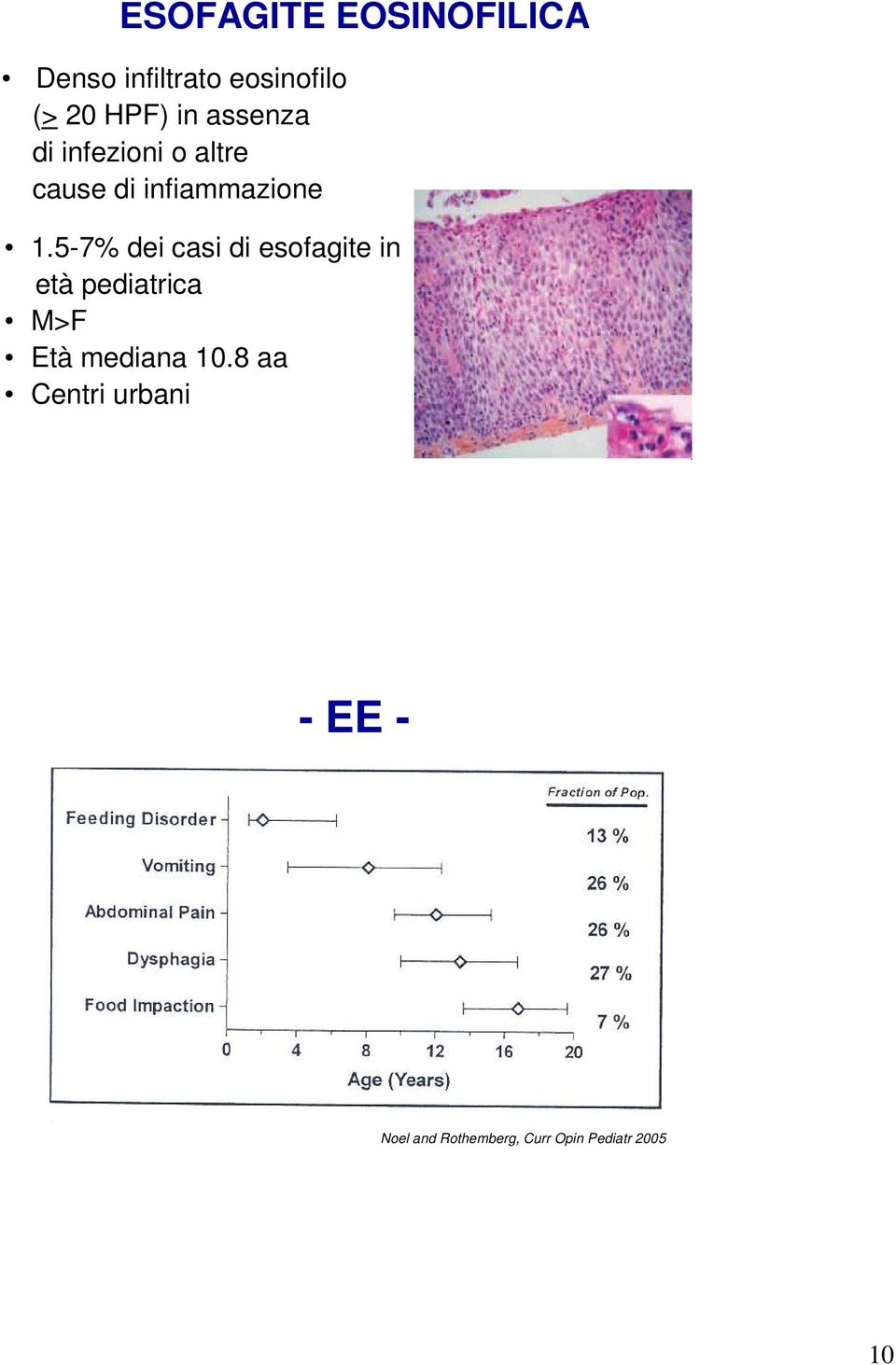 5-7% dei casi di esofagite in età pediatrica M>F Età mediana 10.