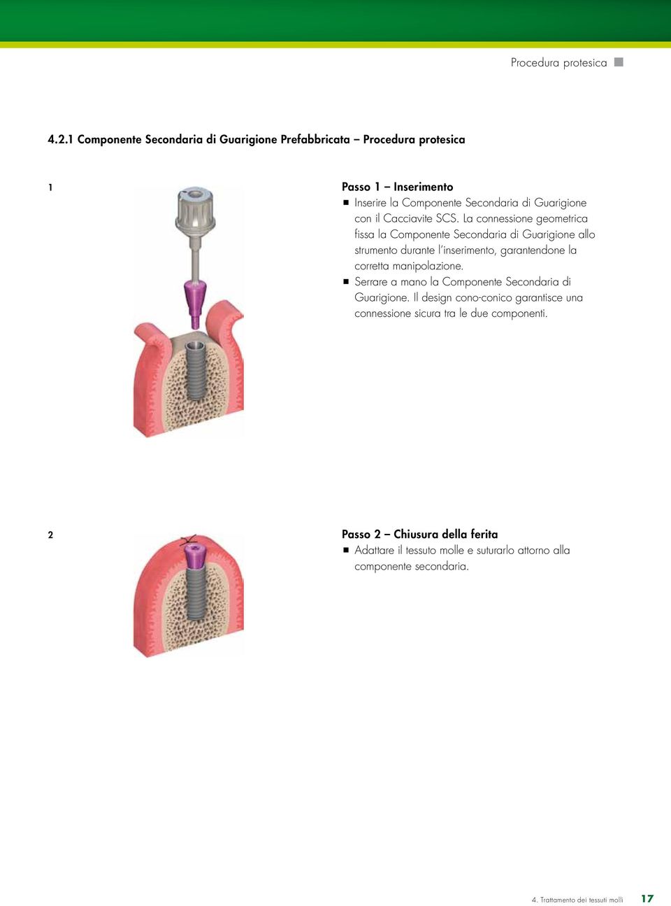 Cacciavite SCS.