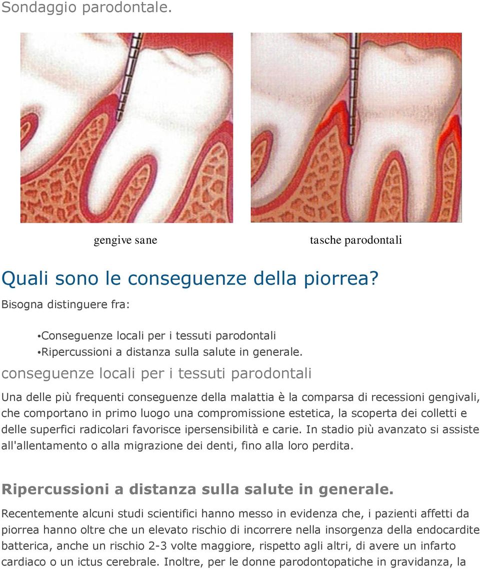 conseguenze locali per i tessuti parodontali Una delle più frequenti conseguenze della malattia è la comparsa di recessioni gengivali, che comportano in primo luogo una compromissione estetica, la