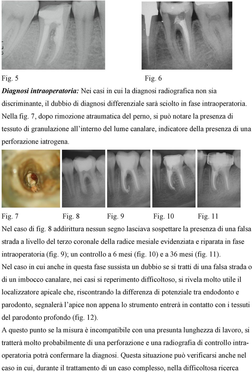 9 Fig. 10 Fig. 11 Nel caso di fig.