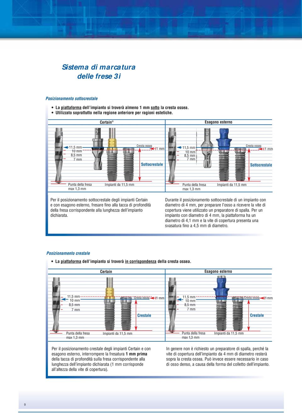 Certain Esagono esterno 11,5 mm 10 mm 8,5 mm 7 mm Cresta ossea 1 mm Sottocrestale 11,5 mm 10 mm 8,5 mm 7 mm Cresta ossea 1 mm Sottocrestale Punta della fresa max 1,3 mm Impianti da 11,5 mm Punta