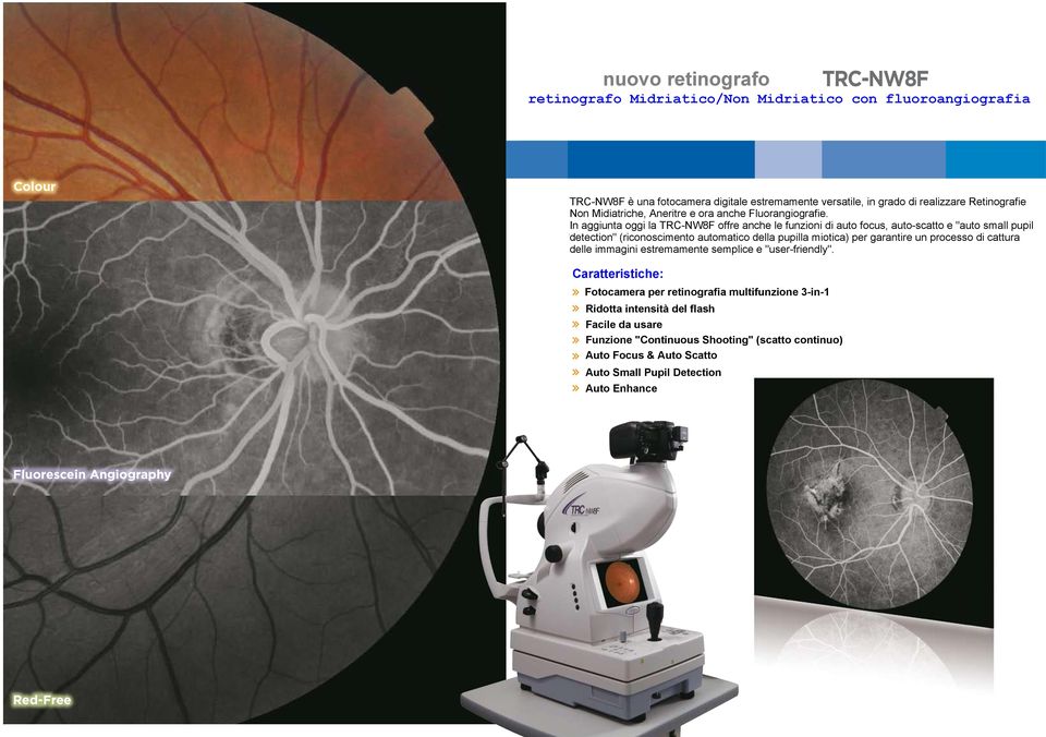 In addition to the above it also now provides auto focus; auto shoot and auto small pupil detection to make the process of image capture extremely