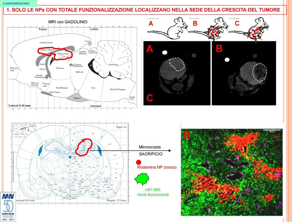 MRI con GADOLINIO A B C A B C B Microscopia