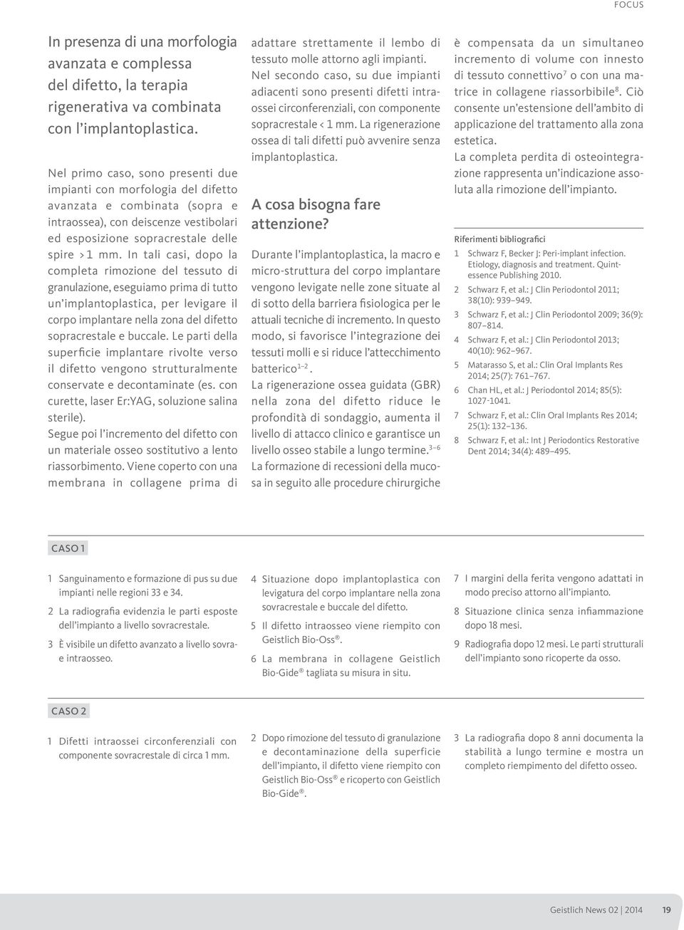 In tali casi, dopo la completa rimozione del tessuto di granulazione, eseguiamo prima di tutto un implantoplastica, per levigare il corpo implantare nella zona del difetto sopracrestale e buccale.