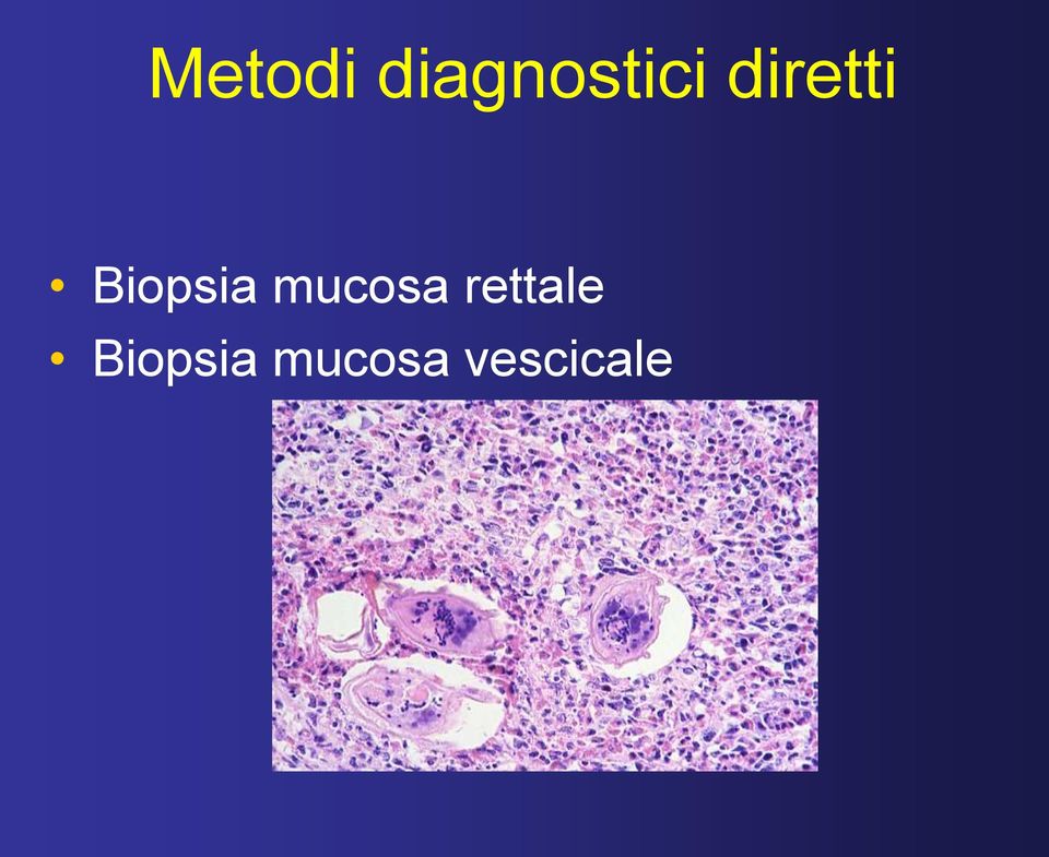 mucosa rettale