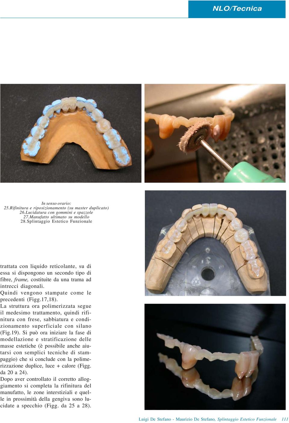 Quindi vengono stampate come le precedenti (Figg.17,18).