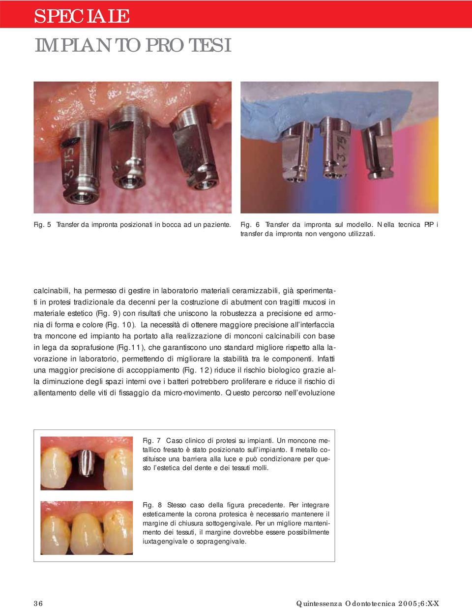 estetico (Fig. 9) con risultati che uniscono la robustezza a precisione ed armonia di forma e colore (Fig. 10).