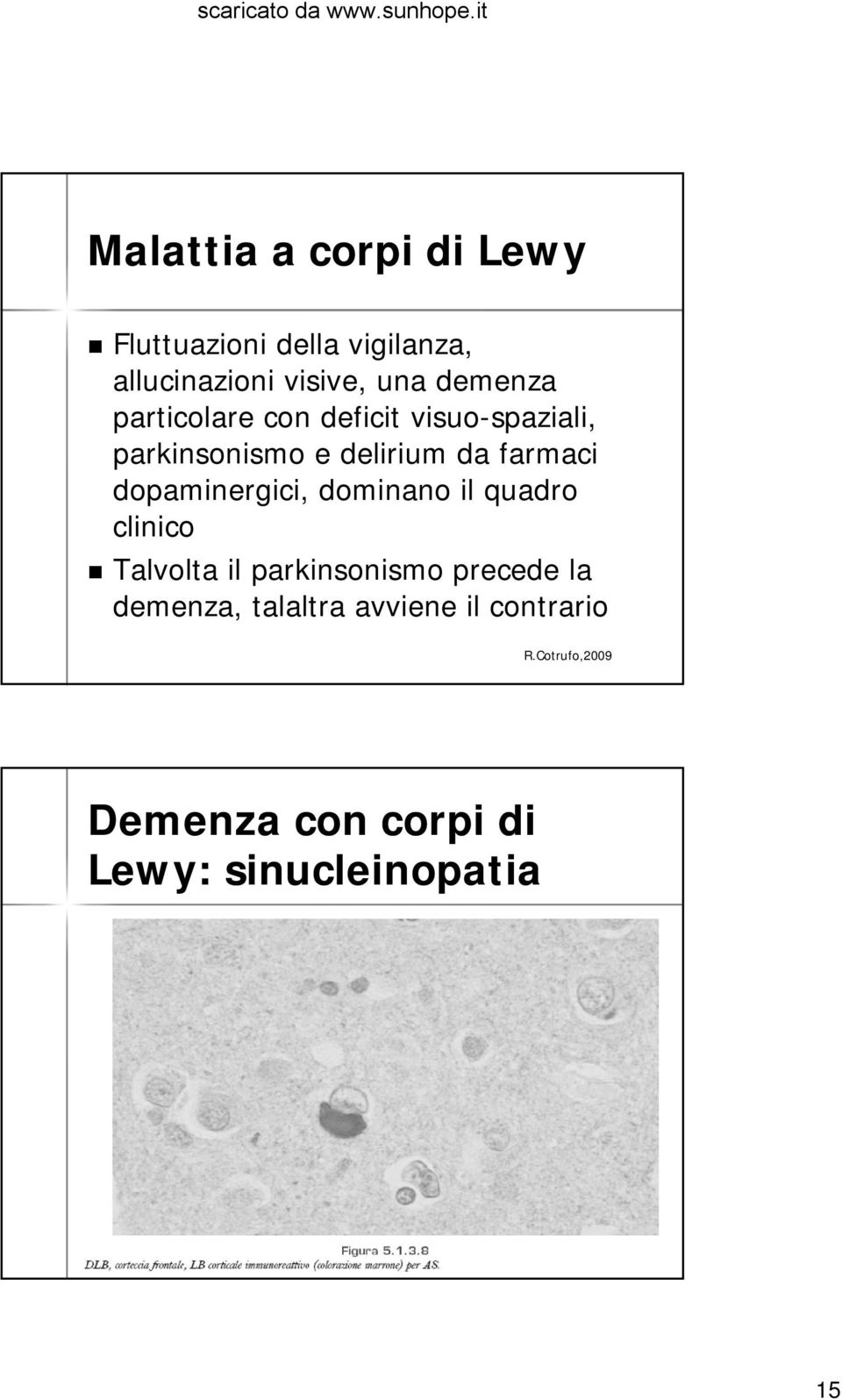 farmaci dopaminergici, dominano il quadro clinico Talvolta il parkinsonismo