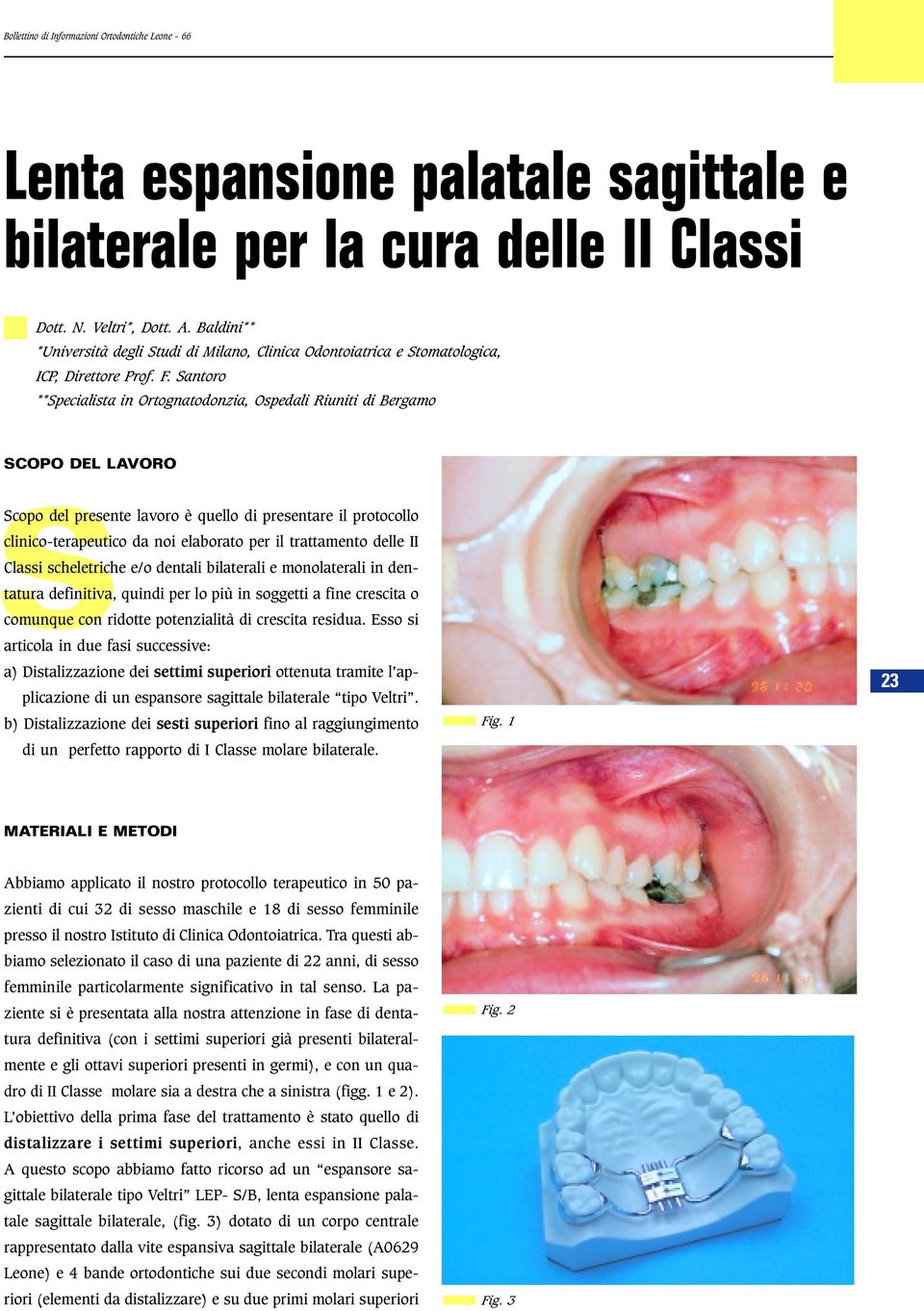 Santoro **Specialista in Ortognatodonzia, Ospedali Riuniti di Bergamo SSCOPO DEL LAVORO Scopo del presente lavoro è quello di presentare il protocollo clinico-terapeutico da noi elaborato per il