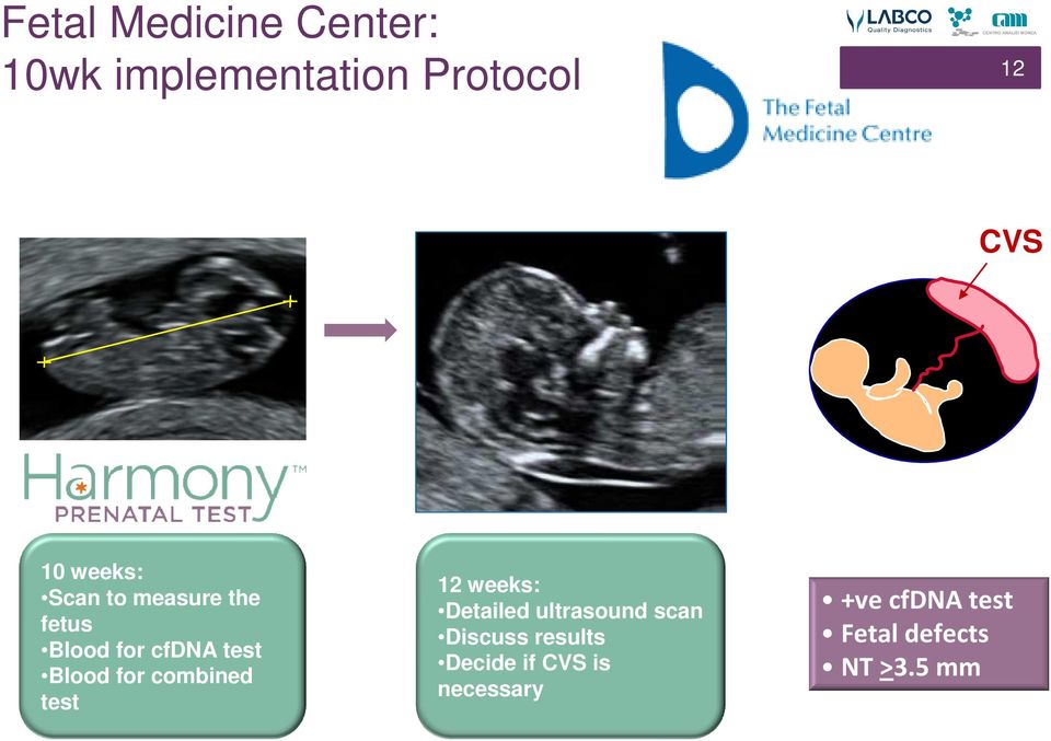 combined test 12 weeks: Detailed ultrasound scan Discuss