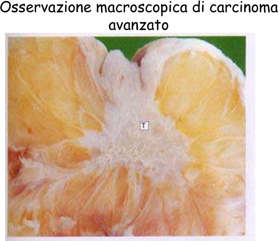 decompressore TIFF (LZW) sono