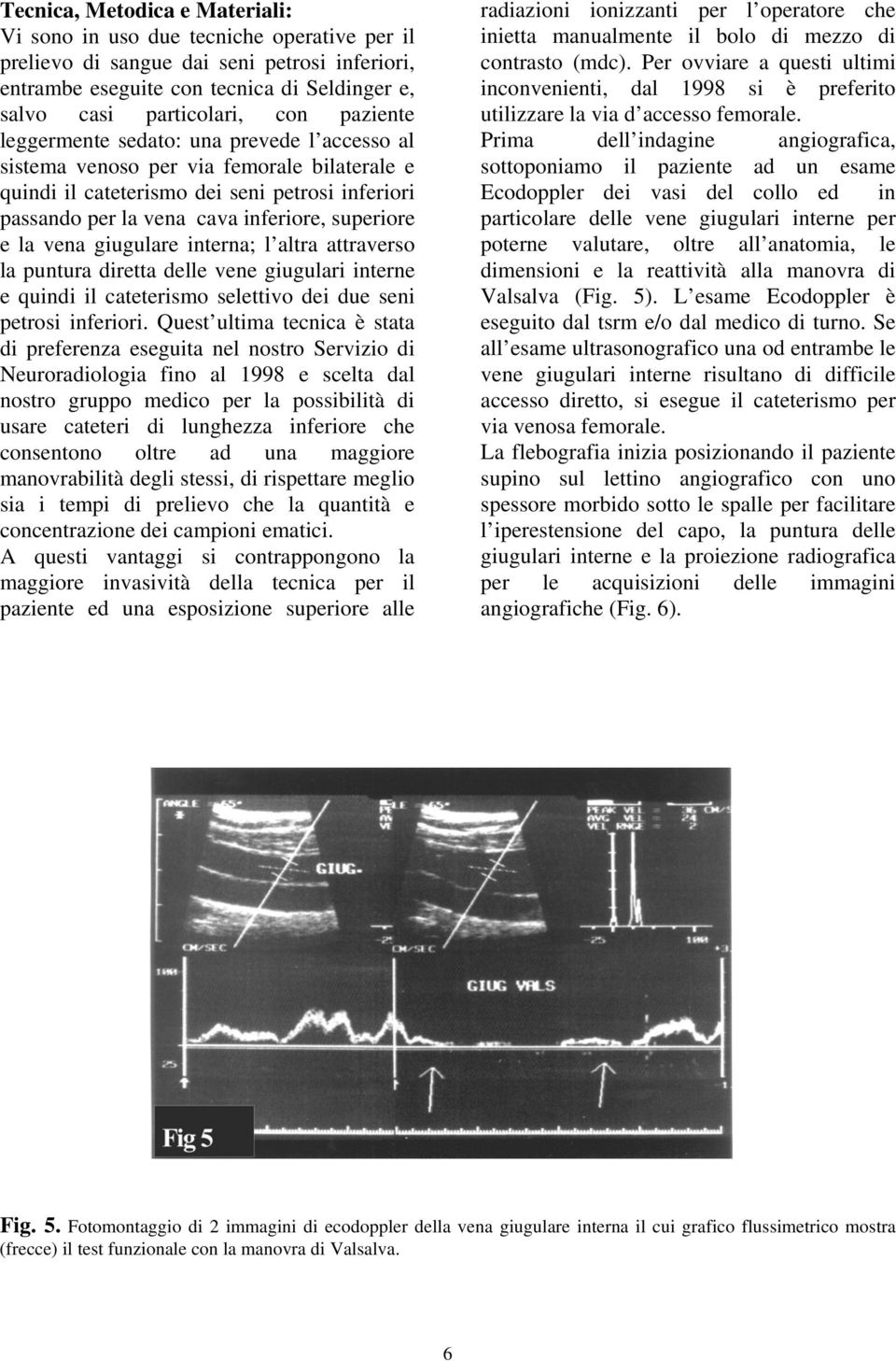 vena giugulare interna; l altra attraverso la puntura diretta delle vene giugulari interne e quindi il cateterismo selettivo dei due seni petrosi inferiori.