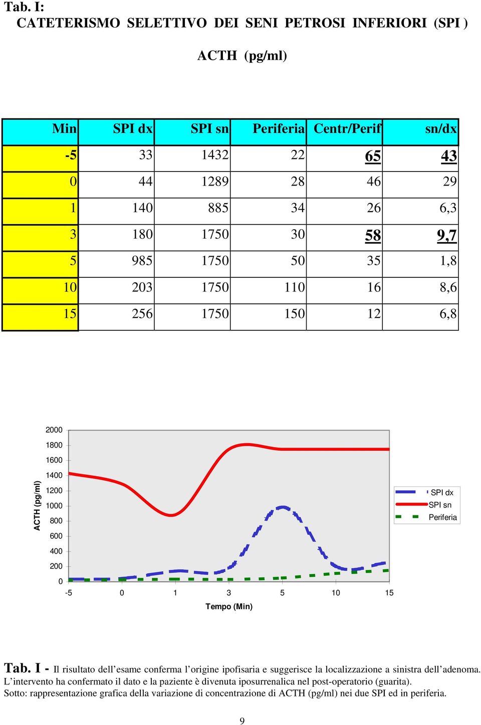 SPI dx SPI sn Periferia Tab. I - Il risultato dell esame conferma l origine ipofisaria e suggerisce la localizzazione a sinistra dell adenoma.