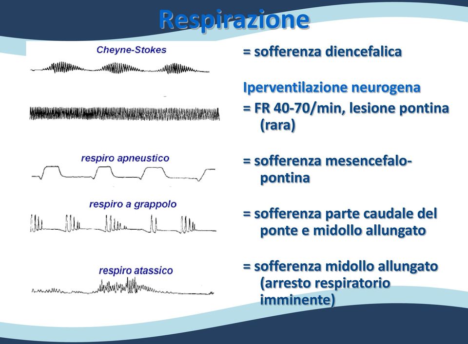 mesencefalopontina = sofferenza parte caudale del ponte e