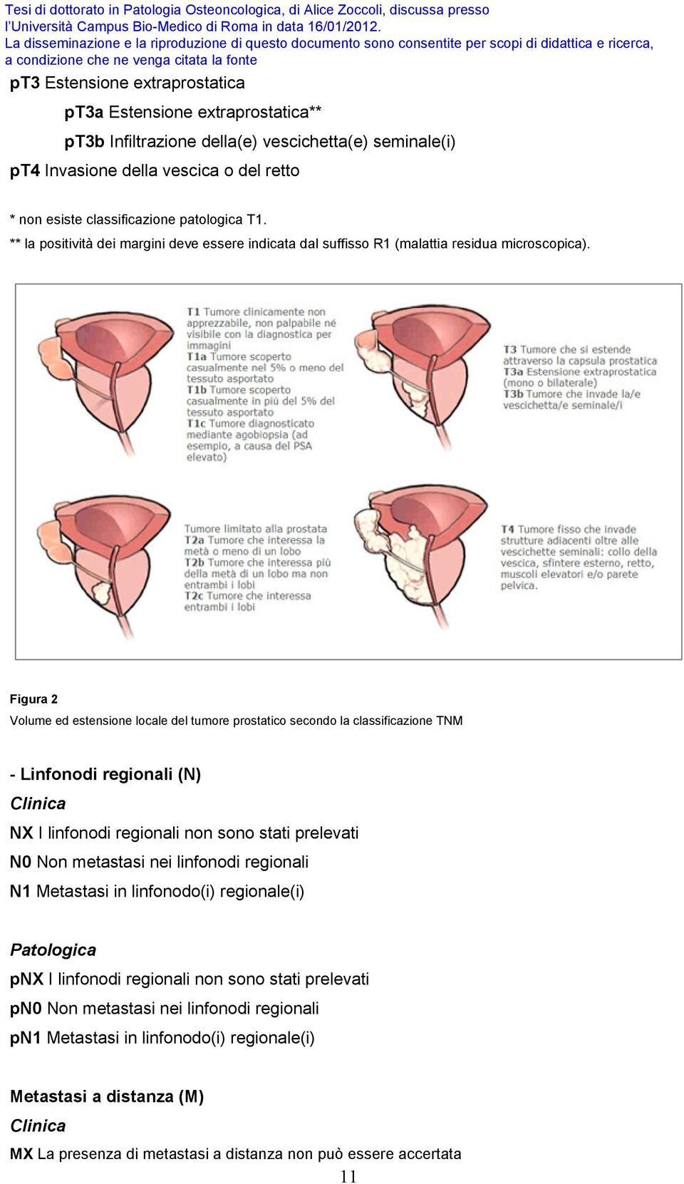 Figura 2 Volume ed estensione locale del tumore prostatico secondo la classificazione TNM - Linfonodi regionali (N) Clinica NX I linfonodi regionali non sono stati prelevati N0 Non metastasi nei