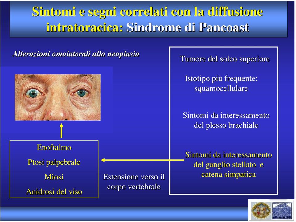 Sintomi da interessamento del plesso brachiale Enoftalmo Ptosi palpebrale Miosi Anidrosi del