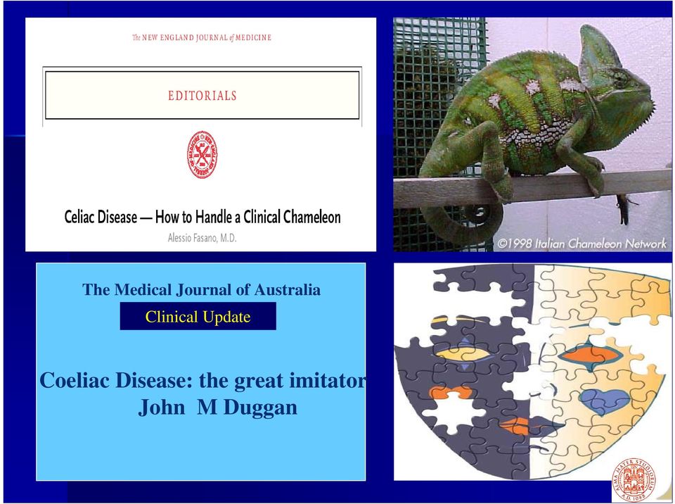 Update Coeliac Disease: